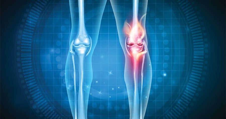 Osteopathy for Arthritis Pain